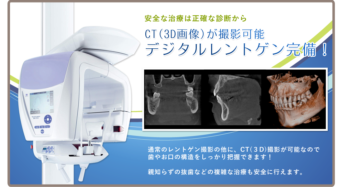 歯科用CT・デジタルレントゲン完備